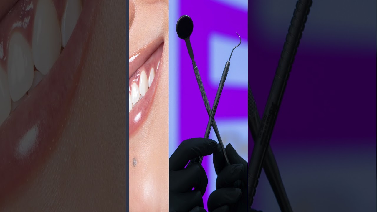 شوف تقييمات عملاءنا بعد تجاربهم للعلاج في F Dental Center | عيادة أسنان | دكتور اسنان
