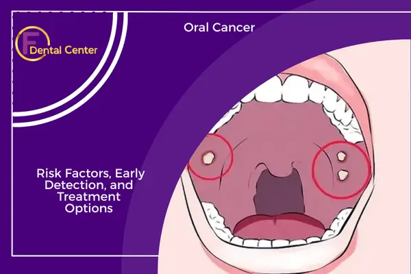 Oral Cancer: Risk Factors, Early Detection, and Treatment Options