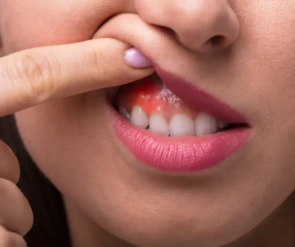 Gum and Oral Health