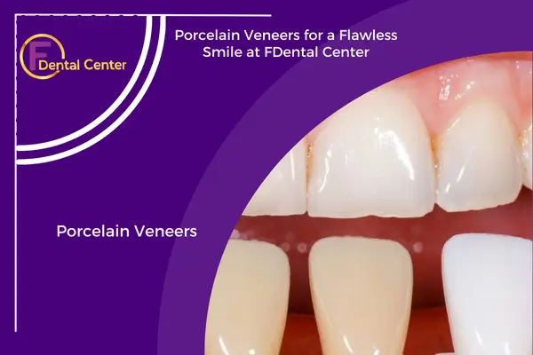 Porcelain Veneers: The Cosmetic Dentistry Solution for a Stunning Smile