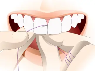 Flossing and Cavities: How This Simple Habit Protects Your Teeth