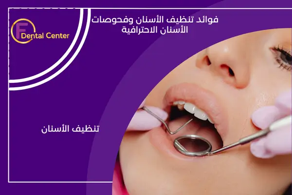 فوائد تنظيف الأسنان وفحوصات الأسنان الاحترافية