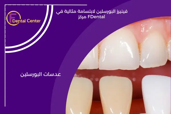 فينير البورسلين: الحل التجميلي لتجميل الأسنان للحصول على ابتسامة مذهلة