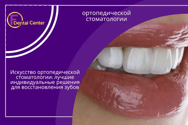 Искусство ортопедической стоматологии: лучшие индивидуальные решения для восстановления зубов