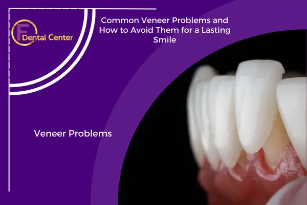 Dental Veneers: Common Issues and How to Avoid Them Effectively
