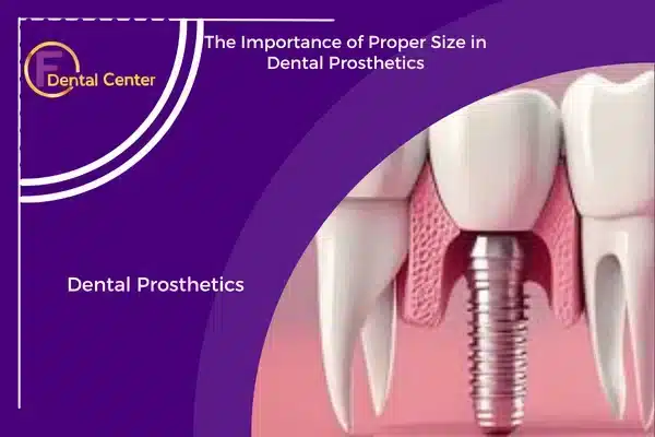 Dental Prosthetics