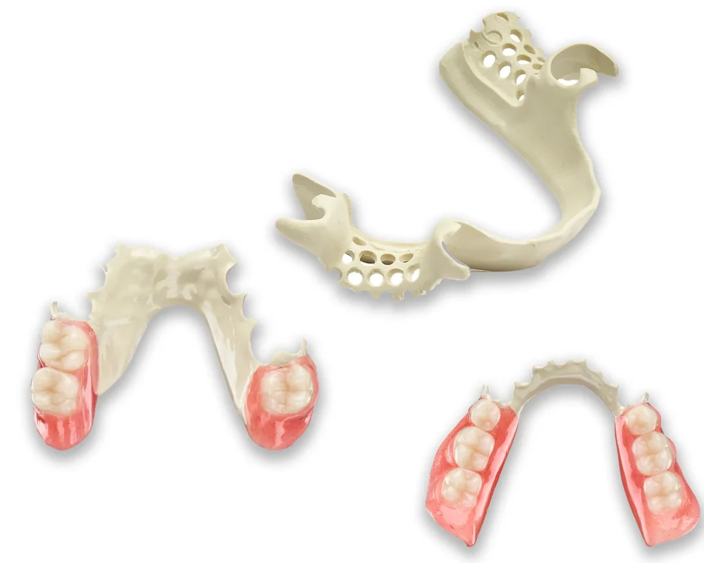Digital Dentistry in Prosthodontics: Precision Meets Innovation