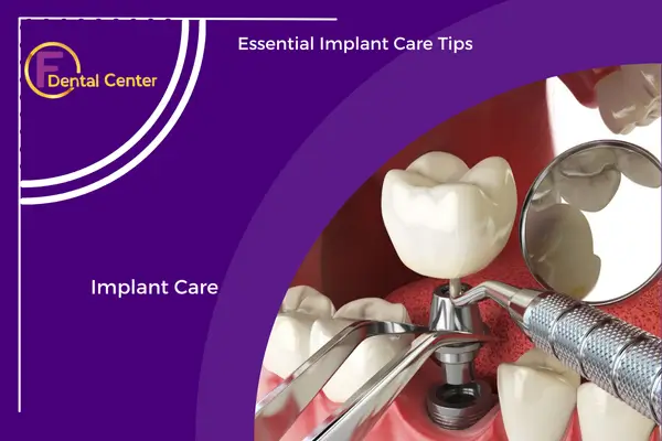 Implant Care: Essential Tips to Protect Your Dental Investment