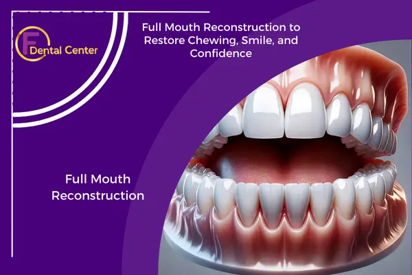 Full Mouth Reconstruction: Total Dental Rehabilitation for Function & Beauty