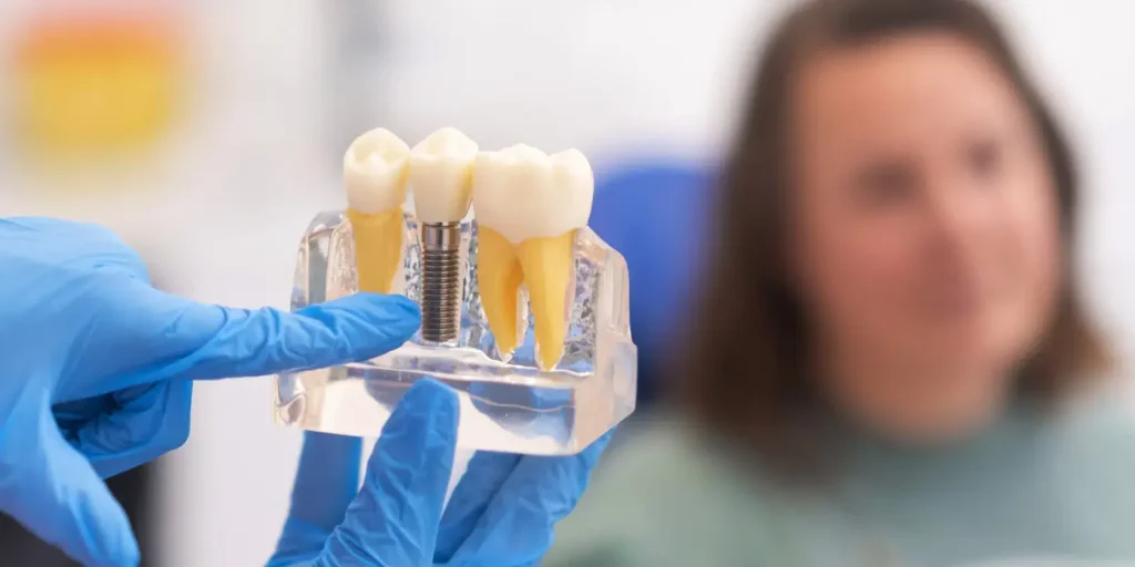 Implant Care: Essential Tips to Protect Your Dental Investment