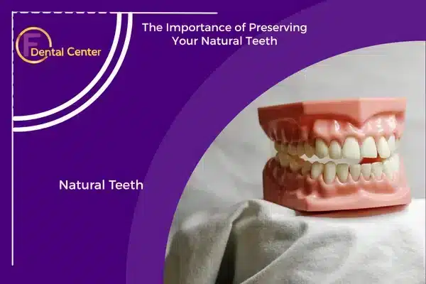 Natural Teeth