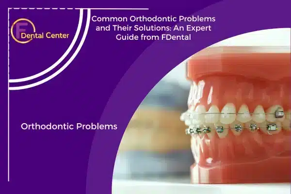 Orthodontic Problems