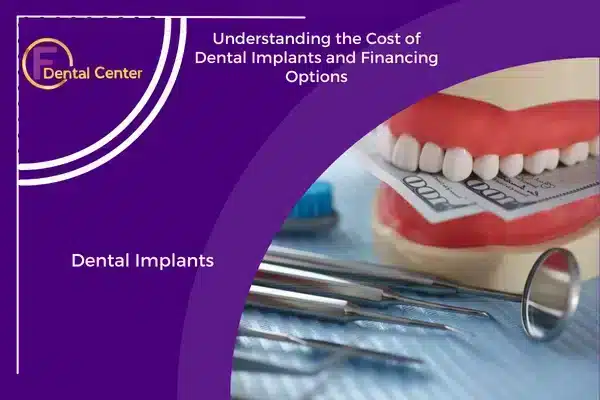 Understanding the Cost of Dental Implants and Financing Options