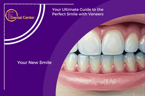 Dental Veneers: The Complete Guide to a Beautiful Smile