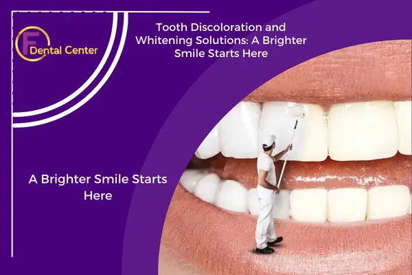 Tooth Discoloration and Whitening Solutions: A Brighter Smile Starts Here