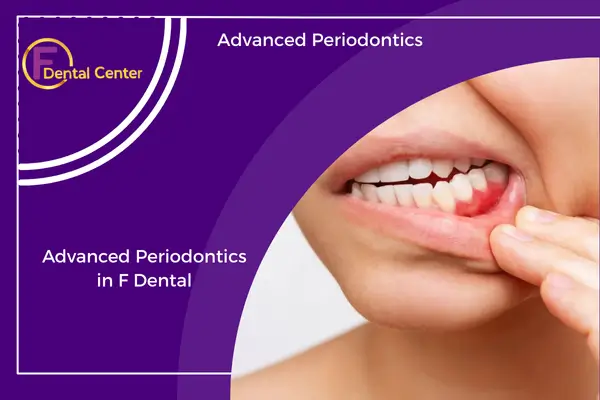 Advanced-Periodontics