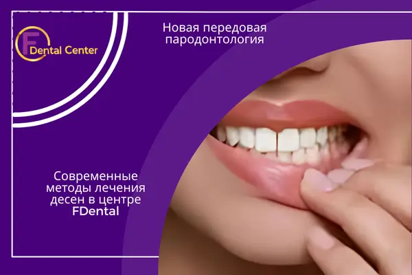 Современные методы лечения десен в центре FDental