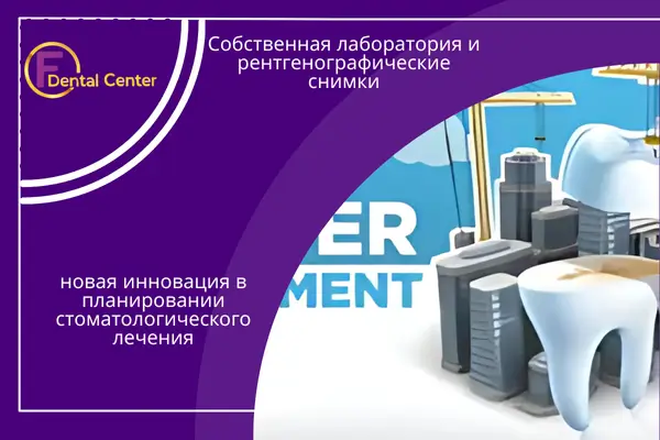 Собственная лаборатория и рентгенографические снимки - новая инновация в планировании стоматологического лечения