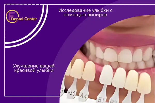 Исследование улыбки с помощью виниров: Улучшение вашей красивой улыбки
