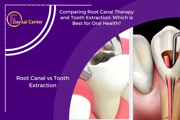 Root Canal or Tooth Extraction: Which Option is Right for You?