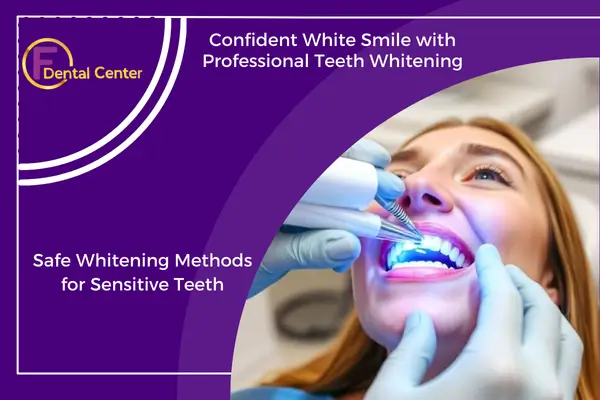 Professional Teeth Whitening: Brighten Your Smile with Safe Bleaching Methods