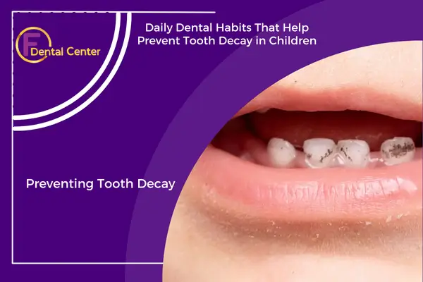Why Tooth Decay in Children Is More Common Than You Think