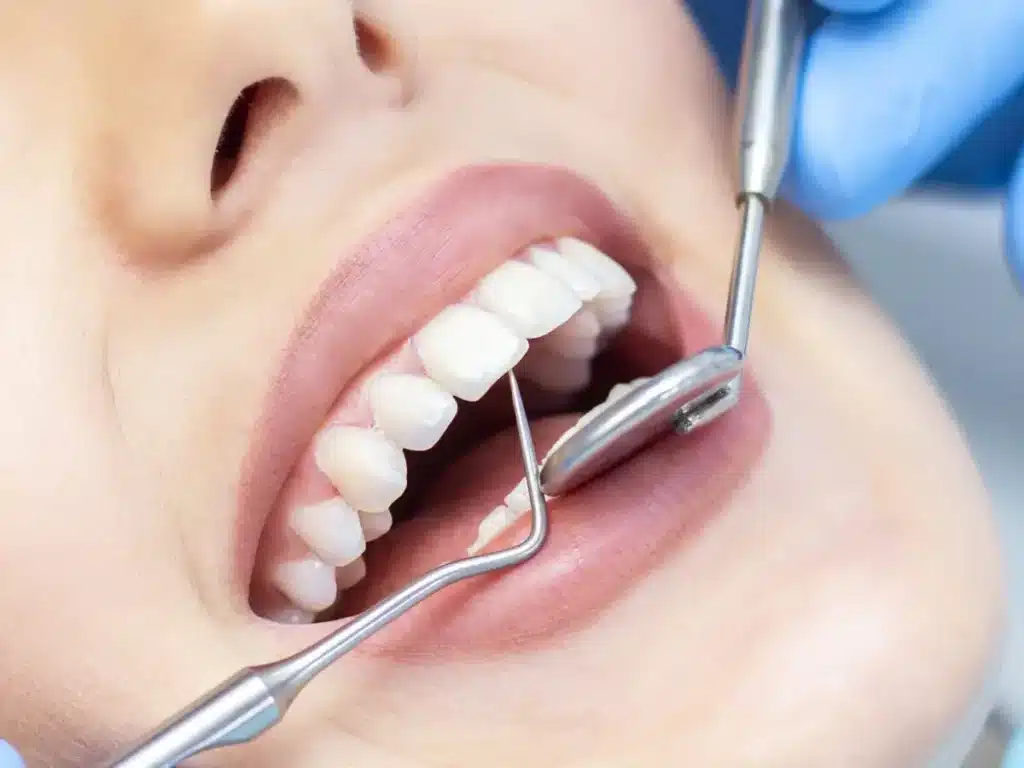 Teeth Cleaning: The Foundation of Long-Term Oral and General Health