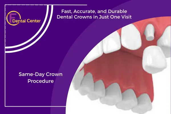 Same-Day Dental Crowns: Convenience Without Compromise