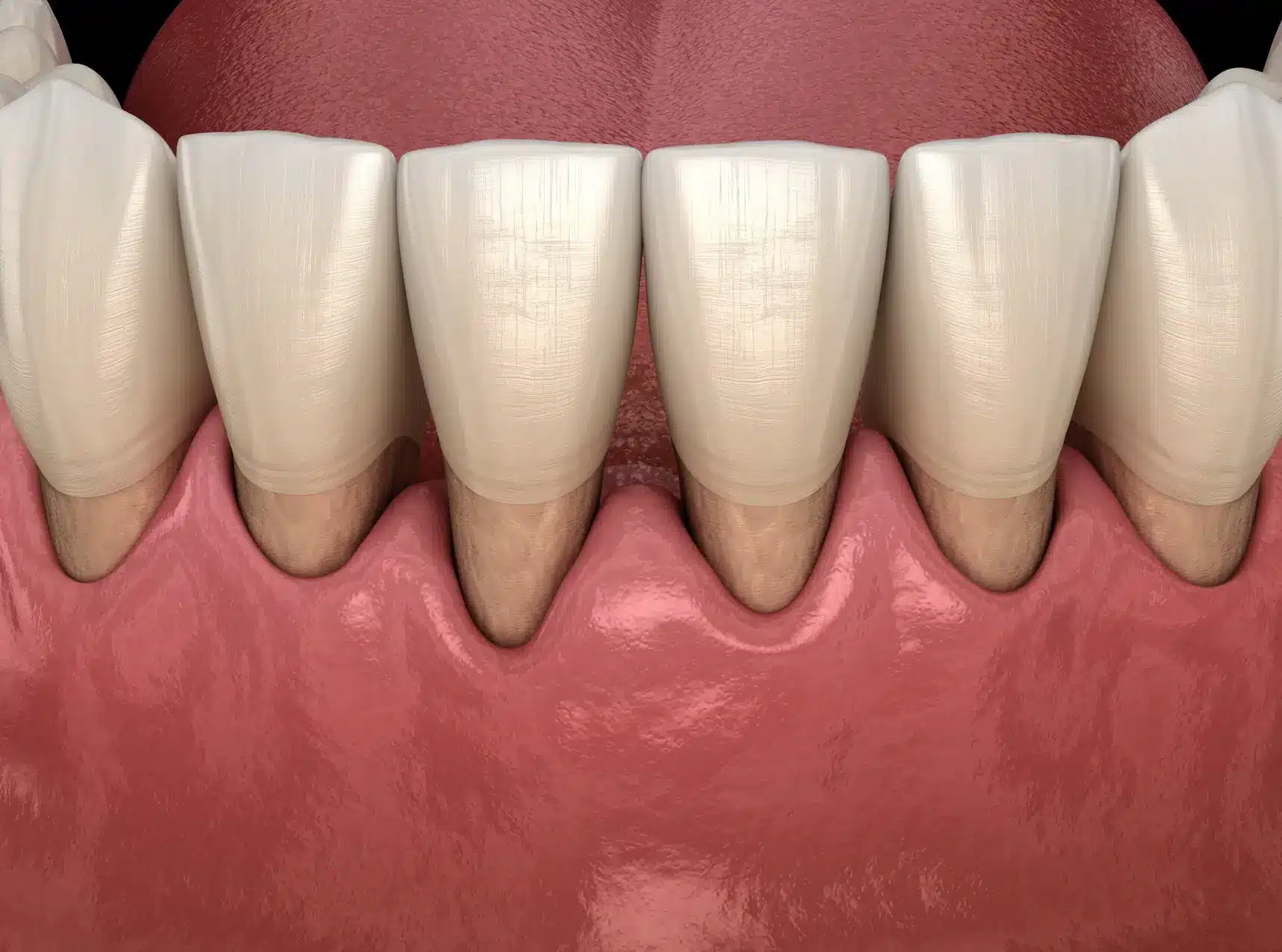 Gum Care Habits That Transform Your Oral Health