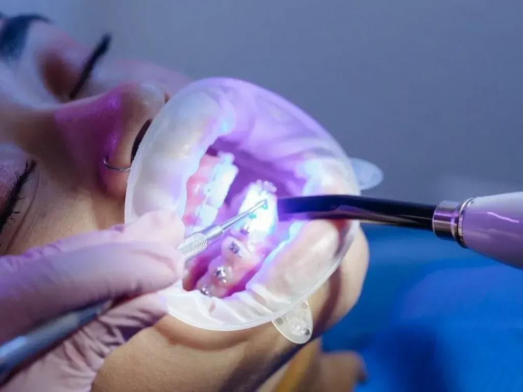 Laser gum therapy