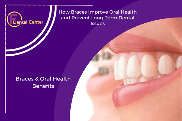Braces for Oral Health: More Than a Straighter Smile