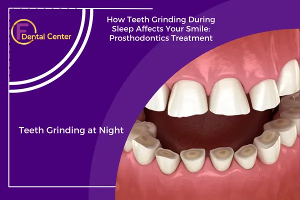 How Teeth Grinding During Sleep Affects Your Smile: Prosthodontics Treatment