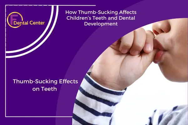 The Impact of Thumb-Sucking on Children's Teeth Development