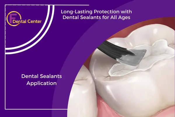 Dental Sealants: A Smart Preventive Choice for All Ages