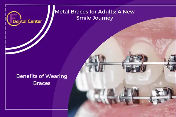 Metal Braces for Adults: A Confident Smile Starts Here