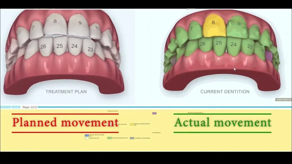 Modern Orthodontic Techniques: Digital Braces and Innovative Smile Correction