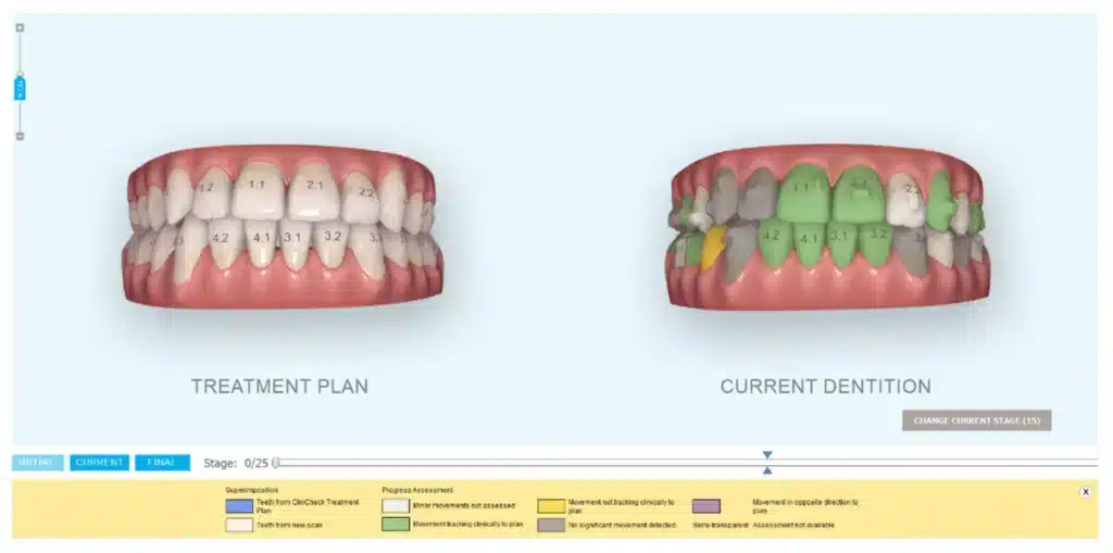 Modern Orthodontic Techniques: Digital Braces and Innovative Smile Correction