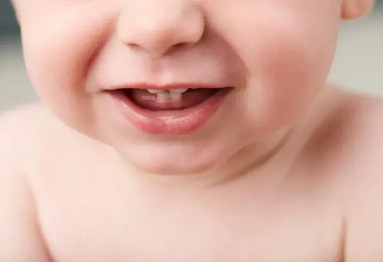 Natal Teeth in Infants: When to Worry and How to Handle It