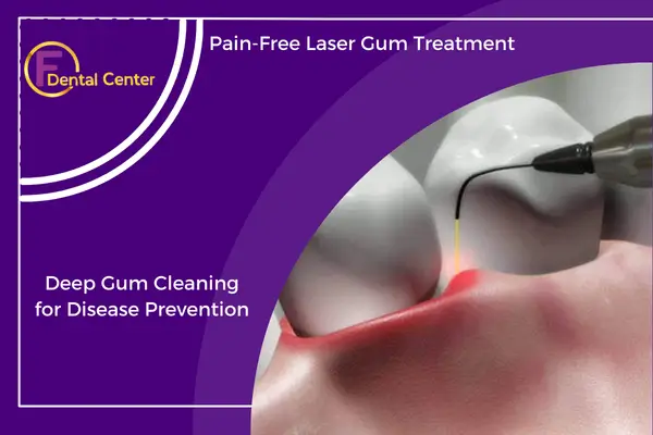 Laser Gum Therapy and Deep Cleaning for Gums: A Modern Approach to Periodontal Disease Prevention