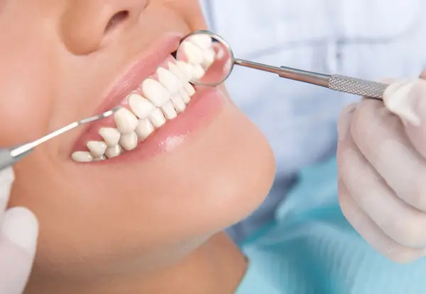 Professional Teeth Whitening: Brighten Your Smile with Safe Bleaching Methods