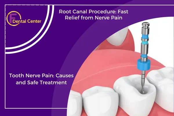 Root Canal Treatment
