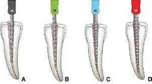 Root Canal Treatment: Advanced Endodontic Procedures for Healthy Teeth