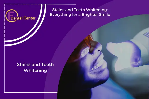 Stains and Teeth Whitening: Everything for a Brighter Smile