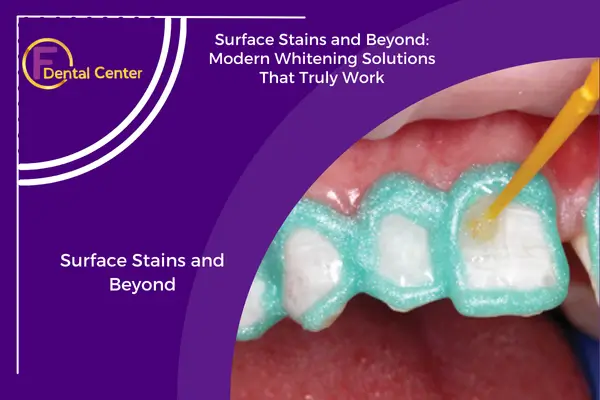 Surface Stains and Beyond