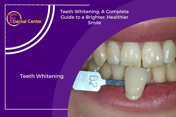 Teeth Whitening: A Complete Guide to a Brighter, Healthier Smile