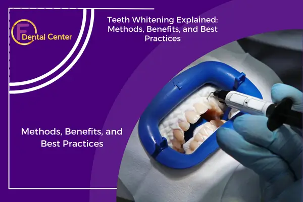 Teeth Whitening Explained: Methods, Benefits, and Best Practices