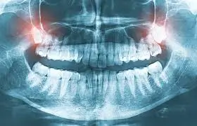 The Role of Panoramic X-rays and CT Scans in Diagnosing Oral Damage