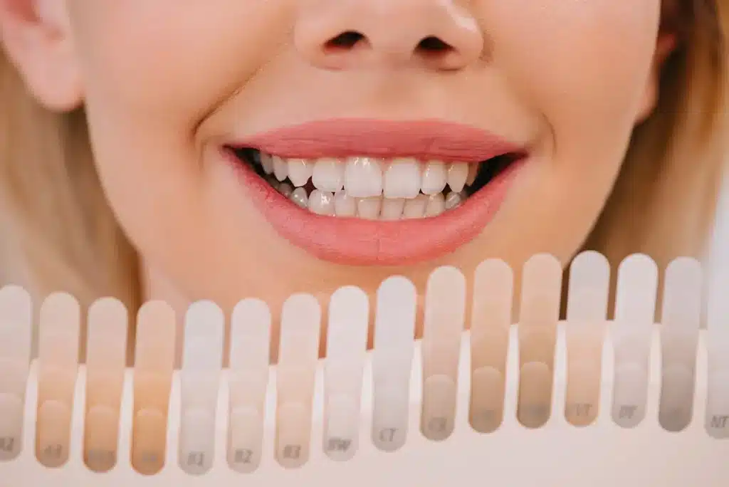 Radiant Results: The Science and Safety of Teeth Whitening