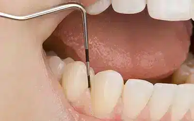 Understanding Common Dental Diseases and Their Impact