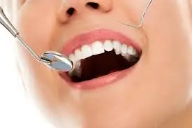 Understanding Common Dental Diseases and Their Impact